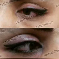 پاکسازی پوست وتتوبدن/پاک تتو قدیمی|خدمات آرایشگری و زیبایی|گرگان, |دیوار