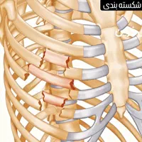 استاد شکسته بندی استخوان در نیشابور