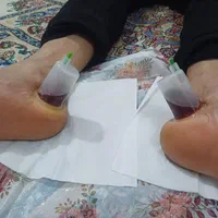 حجامت،زالودرمانی،فصد،برداشت خال و زگیل،در کل شهر|خدمات آرایشگری و زیبایی|مشهد, الهیه|دیوار