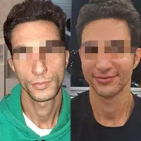 پوست صاف ویکدست میخوای متن آگهی روبخون+پیشنهادویژه|خدمات آرایشگری و زیبایی|قم, باجک دو|دیوار