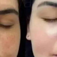 کرم معجزه چهل گیاه عربی سفید کننده ضدلک و جوش|آرایشی، بهداشتی، درمانی|شیراز, دشت چنار|دیوار