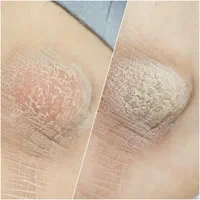 آموزش پدیکور درمانی و زیبایی به صورت تخصصی|خدمات آموزشی|مشهد, آزادشهر|دیوار