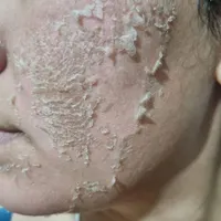 کارگاه آموزشی تکنیک پوست مار و آگلاپیل و اگزوزوم|خدمات آموزشی|فولادشهر, B5|دیوار