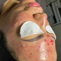 پاکسازی تخصصی پوست آقایان و بانوان|خدمات آرایشگری و زیبایی|گلستان (تهران), |دیوار