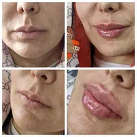 منشی مطب پوست و مو و لیزر ویژه بانوان /پاره وقت|استخدام درمانی، زیبایی، بهداشتی|تهران, قنات‌کوثر|دیوار