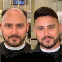 پروتز مو ، چسب پروتز ، ترمیم و تعویض چسب|خدمات آرایشگری و زیبایی|تبریز, |دیوار