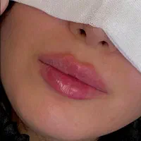بابیمه تکمیلی حجامت، بادکش فصد،بوتاکس زالو سیاتیک|خدمات آرایشگری و زیبایی|اصفهان, وحید|دیوار