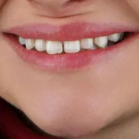 دندانپزشکی دکتر محمد ناصری|خدمات آرایشگری و زیبایی|کرمانشاه, |دیوار