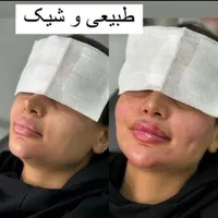 خدمات تخصصی ژل و بوتاکس|خدمات آرایشگری و زیبایی|شاهین‌شهر, فردوسی|دیوار