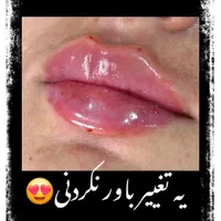 آموزش ژل بوتاکس سابسیژن مزوتراپی مزونیدل فیلربادی|خدمات آموزشی|کرج, مهرویلا جنوبی|دیوار
