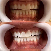 دندانپزشکی،ازاد،بیمه انلاین وکتبی،اقساط|خدمات آرایشگری و زیبایی|تهران, هفت حوض|دیوار