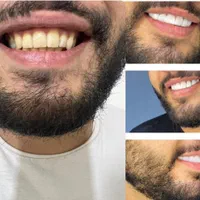 هدف ما کاهش های شماست در دندانپزشکی