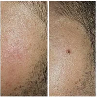 مرکز زیبایی دکتر تقوی|خدمات آرایشگری و زیبایی|یاسوج, |دیوار