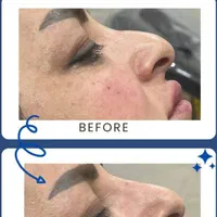 تخفیفات ویژه/اگزوزوم/مزو ژل/لیفتینگ/فشیال تخصصی|خدمات آرایشگری و زیبایی|شیراز, وحدت|دیوار