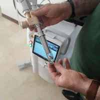 لیزر فوتونا Co2 fractional Co2 laser|پزشکی|تهران, مهران (سیدخندان)|دیوار