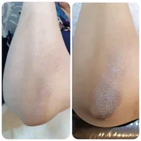 پاکسازی و فیشال تخصصی|خدمات آرایشگری و زیبایی|شاهین‌شهر, فردوسی|دیوار