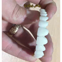 کلینیک تخصصی روکش و روکش ایمپلنت با تضمین کیفیت