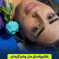 جراحی تخصصی بلفاروپلاستی با تکنیک جدید|خدمات آرایشگری و زیبایی|تهران, پاسداران|دیوار