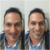 خدمات دندان مصنوعی|خدمات آرایشگری و زیبایی|اصفهان, ارداجی|دیوار