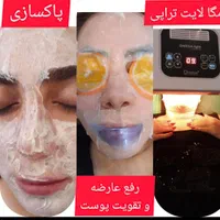 لاغری با دستگاه پاکسازی فیشال هایفو تراپی|خدمات آرایشگری و زیبایی|زنجان, |دیوار