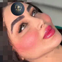 تزریق تخصصی ژل ومادلینگ خلیجی واروپایی وبوتاکس|خدمات آرایشگری و زیبایی|کرمانشاه, |دیوار