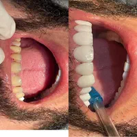 دندانسازی|خدمات آرایشگری و زیبایی|اهواز, کیانپارس |دیوار