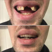 دندانسازی میعاد دندان مصنوعی|خدمات آرایشگری و زیبایی|کرمان, |دیوار