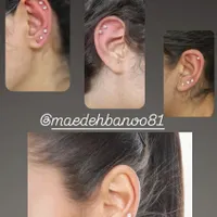 گوشواره طبی و سوراخ کردن گوش
