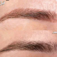 پاک کردن انواع تتو رنگی خالکوبی صورت وبدن بالیزر|خدمات آرایشگری و زیبایی|یاسوج, |دیوار