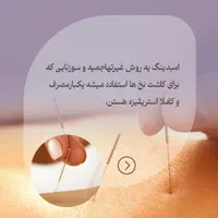حجامت بادکش امبدینگ طب سوزنی فصد خون زگیل تناسلی|خدمات آرایشگری و زیبایی|اصفهان, سعادت‌آباد|دیوار