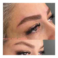 تزریق ژل وبوتاکس،نخ کاگ یالیفت صورت،اموزش|خدمات آرایشگری و زیبایی|تهران, شهرک شریعتی|دیوار