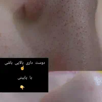 پاکسازی و فیشیال پوست|خدمات آرایشگری و زیبایی|اهواز, فاز ۲ پادادشهر|دیوار