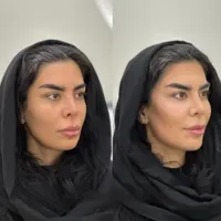 مرکز زیبایی درمانی سبز|خدمات آرایشگری و زیبایی|دورود, |دیوار