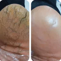پارافین تراپی وکفسابی