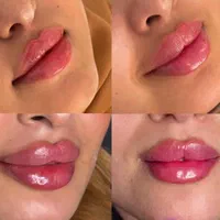 آموزش و انجام خدمات پوست و مو ژل و بوتاکس و..|خدمات آرایشگری و زیبایی|نور, |دیوار