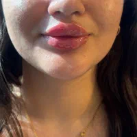 کلینیک لاغری زیبایی لیزر و روان لیلیانا|خدمات آرایشگری و زیبایی|سرخرود, |دیوار