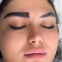 کاشت مو ابرو ریش سیبیل در مشهد توسط متخصص پوست|خدمات آرایشگری و زیبایی|مشهد, ملک‌آباد|دیوار