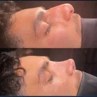 خدمات جراحی زیبایی با شرایط ویژه تابستانی|خدمات آرایشگری و زیبایی|تهران, مهران (سیدخندان)|دیوار