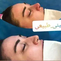 تخفیف۵۰درصدی عمل بینی ب مناسبت مبعث رسول|خدمات آرایشگری و زیبایی|تهران, شهرک غرب|دیوار