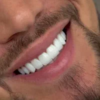 کامپوزیت دندان/ایمپلنت/کلیه امور درمانی و زیبایی|خدمات آرایشگری و زیبایی|اصفهان, کوی ولی عصر|دیوار