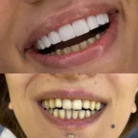دندانپزشکی طرح لبخند|خدمات آرایشگری و زیبایی|قم, زنبیل آباد|دیوار