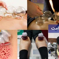 حجامت زالو درمانی طیب|خدمات آرایشگری و زیبایی|اسلام‌شهر, شهرک سالور|دیوار