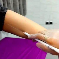 لیزر مو کندلا 2022 (سری شخصی )|خدمات آرایشگری و زیبایی|شوش, |دیوار