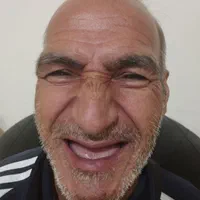 ساخت دست دندان و رفع لقی و شکستگی|خدمات آرایشگری و زیبایی|تهران, سبلان (لشگر)|دیوار