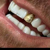 عصب کشی دندان (۱۲۰۰) دندانپزشکی تعرفه دولتی
