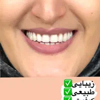 دندانسازی مرکزی ساخت انواع دندان مصنوعی