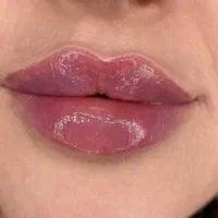 کلینیک لیزر/لیفت/تزریق ژل نورامیس،رئوفیل/بوتاکس|خدمات آرایشگری و زیبایی|تهران, صادقیه|دیوار
