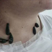 مشاوره حجامت و بادکش گرم زالو فصد خون امبدینگ|خدمات آرایشگری و زیبایی|اصفهان, دشتستان|دیوار