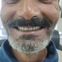 دندانسازی ،دندان مصنوعی،دندان،باضمانت وتحویل فوری|خدمات آرایشگری و زیبایی|مشهد, طلاب|دیوار