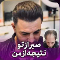 کاشت مو ابرو ریش سیبیل در مشهد توسط متخصص پوست|خدمات آرایشگری و زیبایی|مشهد, ملک‌آباد|دیوار